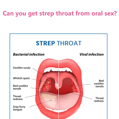 can you get strep throat from oral sex