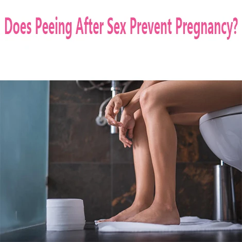 Does Peeing After Sex Prevent Pregnancy