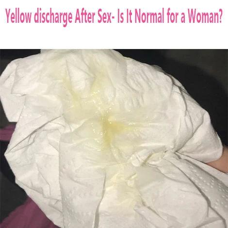 yellow discharge after sex