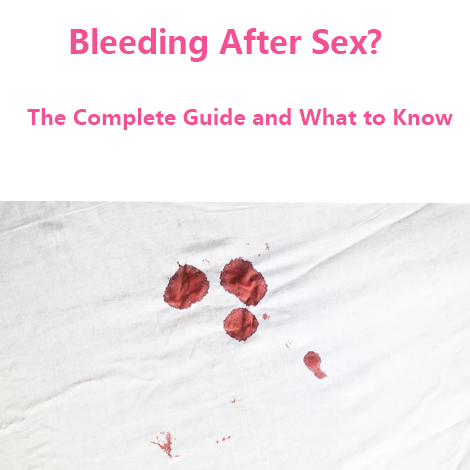 bleeding after sex